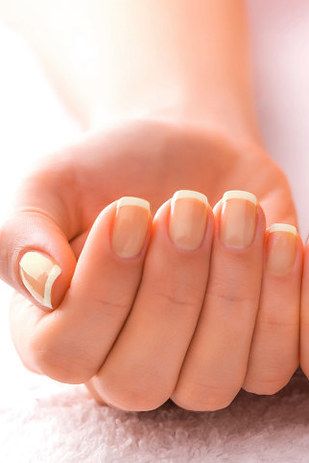 Yellowed nails, which is one of the nail problems