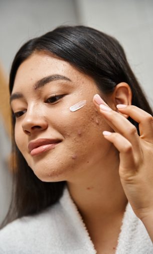 acne treatment cream on face of young asian woman with brunette hair looking away, close up