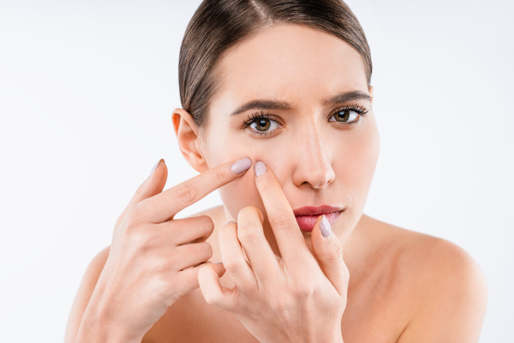 Displeased shirtless woman with acne touching her head isolated over white background