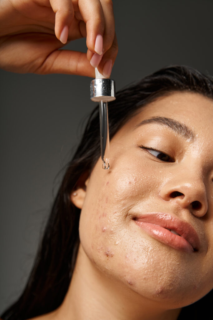 pretty young asian woman with acne prone skin holding dropper with serum on grey background. acne care. acne home care. facial care. face care.