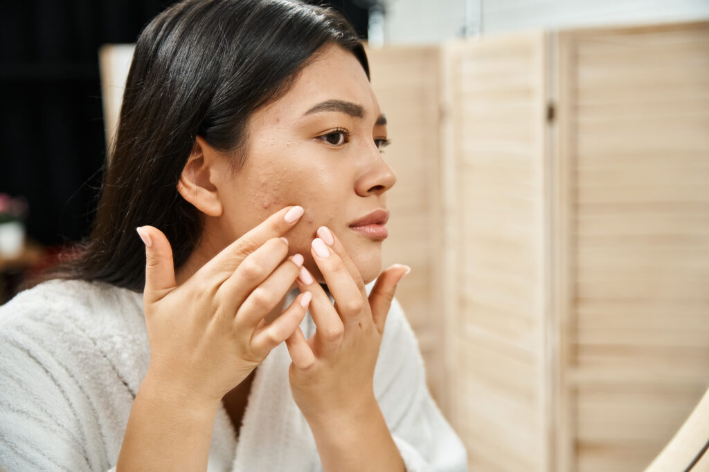 young asian woman with brunette hair examining her skin with acne in bathroom mirror, skin issue.  acne care. acne home care. facial care. face care.