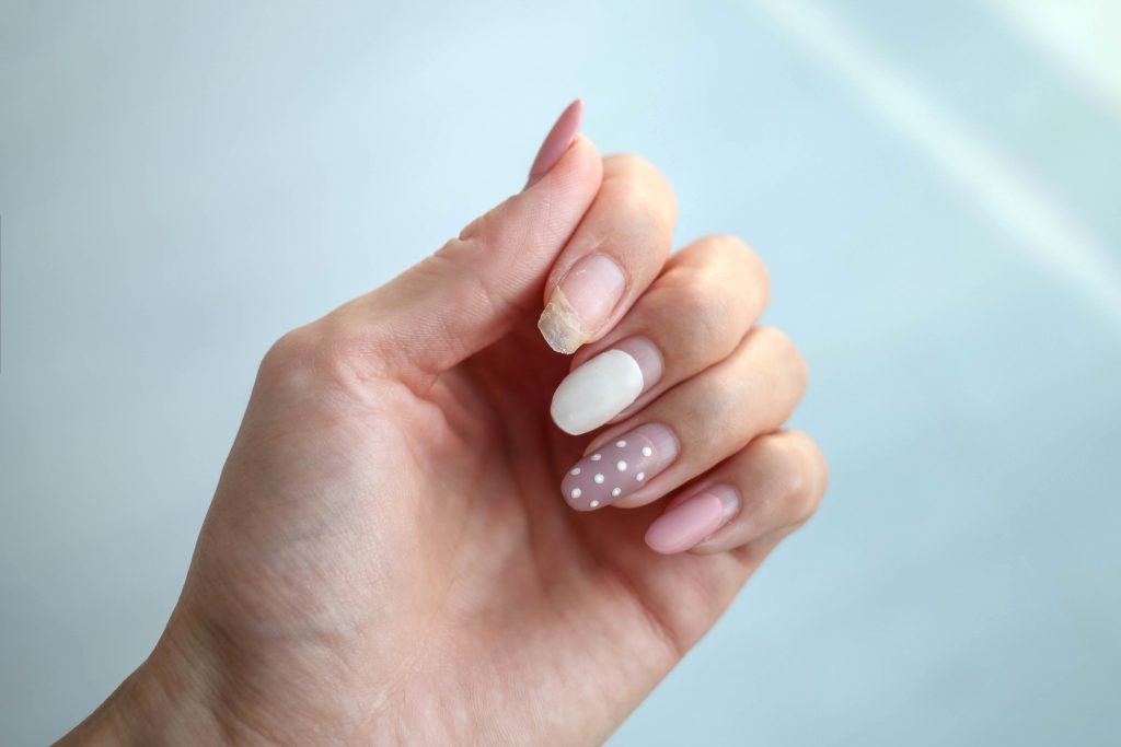 Weak thin nail. Consequences of gel polish manicure. Regrown nails after shellac. How to Fix Broken Nail Without Starting Over.
